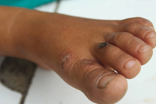 Podologia infantil no Rio de Janeiro