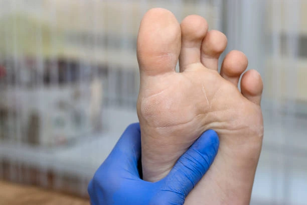 Tirar rachadura do pe